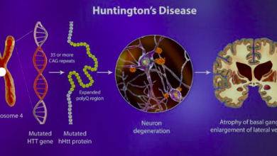 Huntington,s Disease